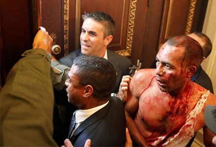 Venezuelan lawmakers injured,National Assembly